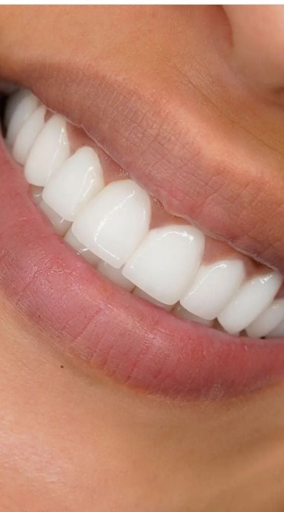 White teeth paint