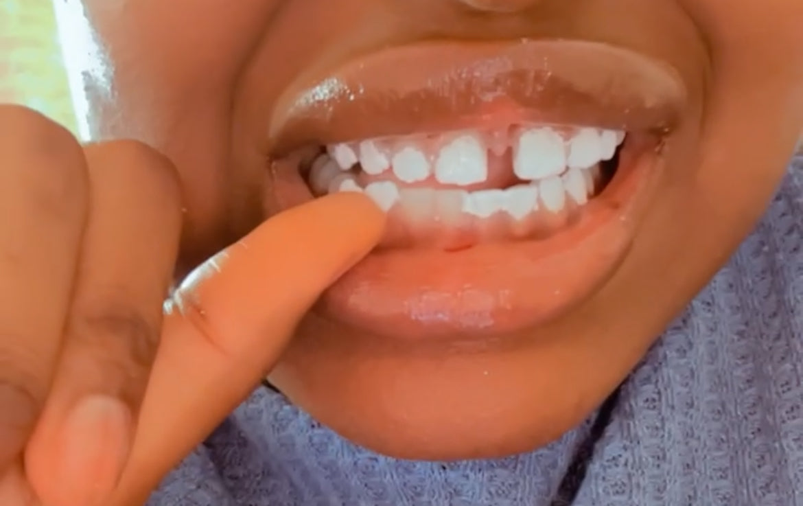 White teeth paint
