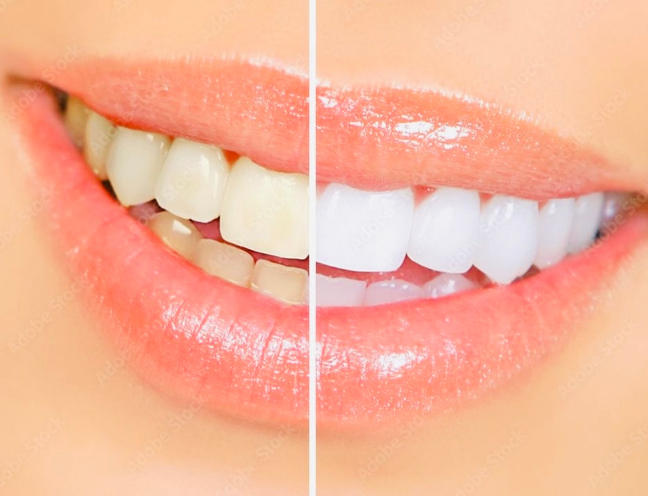White teeth paint